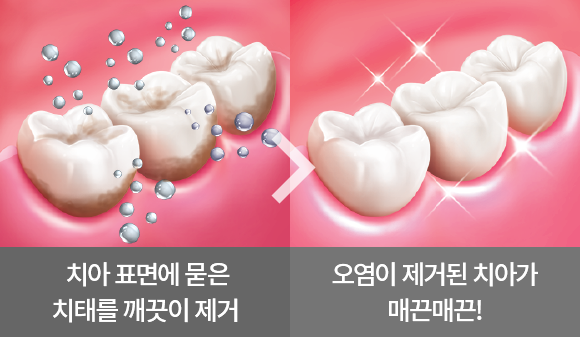 제품 특징 이미지